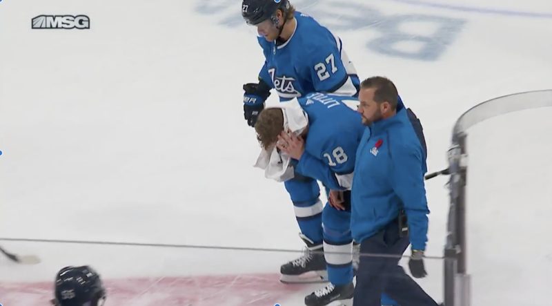 Winnipeg Jets' Bryan Little gets 25-30 stitches, sent to