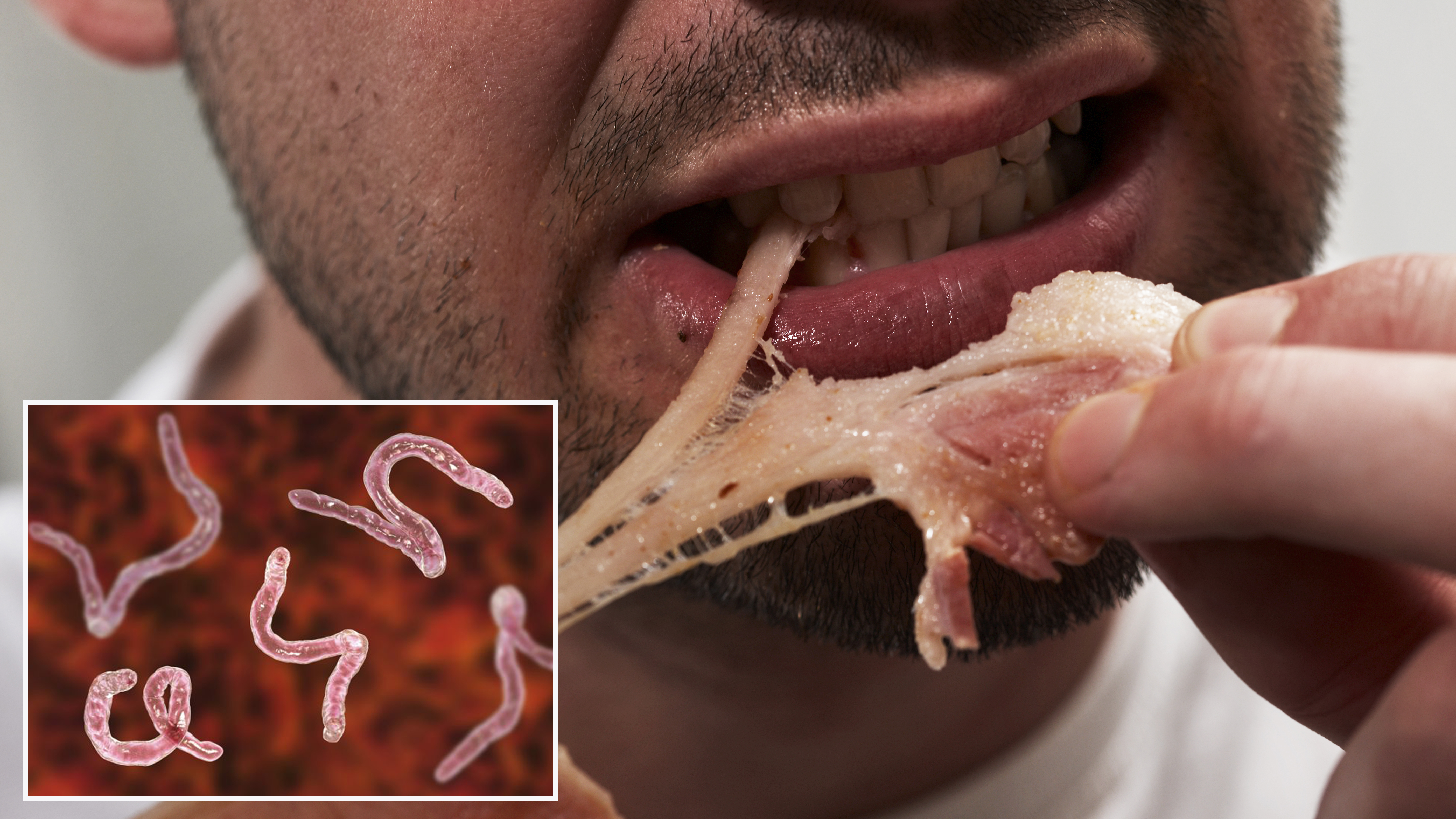 advice juice Glamor Man had 700 tapeworms in his brain after eating undercooked pot