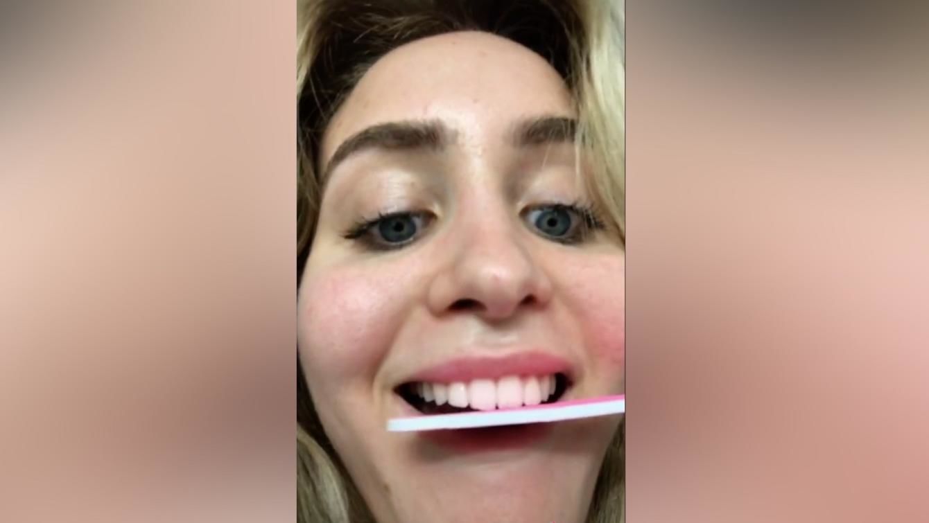 La Nueva Y Peligrosa Tendencia De Tik Tok Que Te Destroza Los Dientes