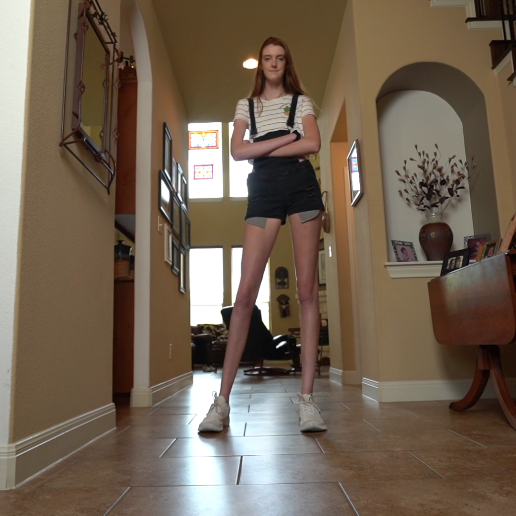Guinness World Records Says Teen Has The Worlds Longest Legs ‘you Don