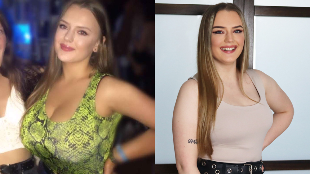 Mum, 26, with size H boobs asking strangers for £10k to have breast  reduction surgery after being left in crippling pain