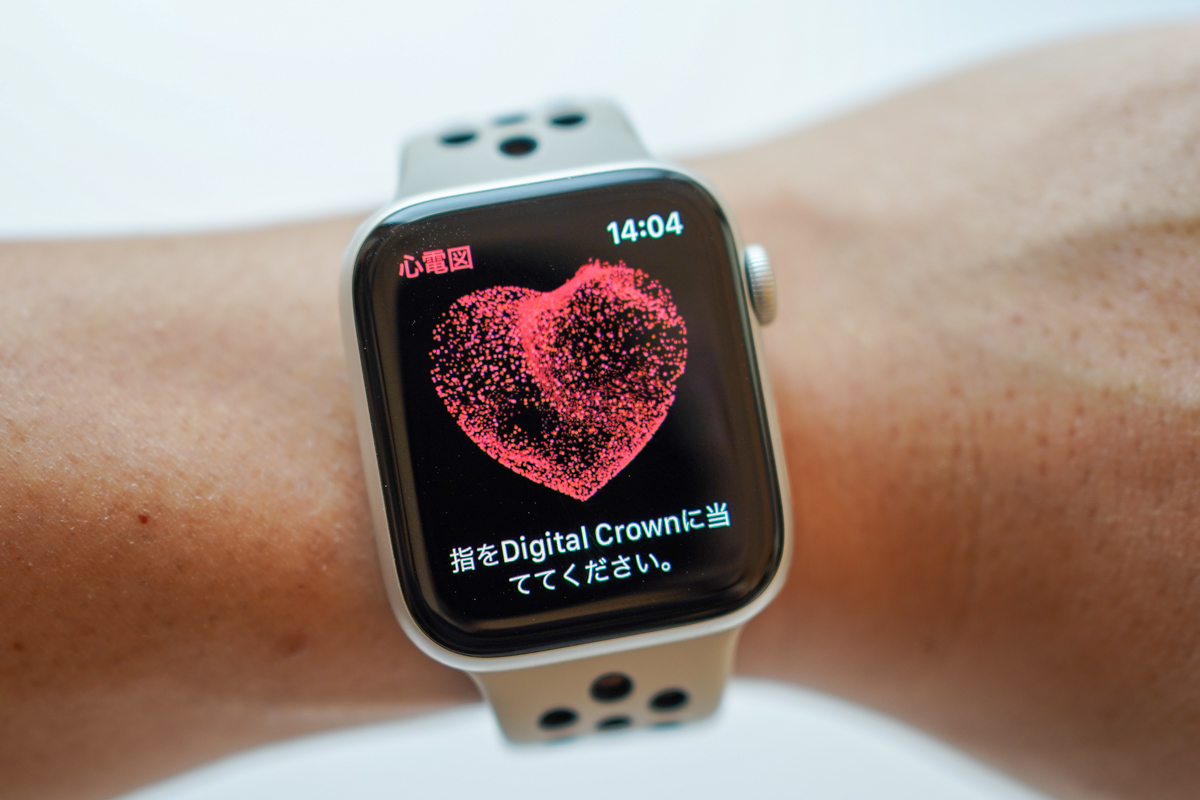 慶應義塾大、全国のApple Watchユーザーを対象にした臨床研究を開始