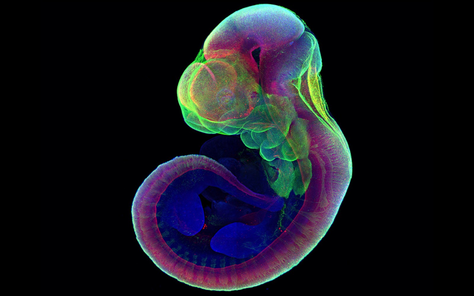 This mouse embryo grew into an artificial uterus