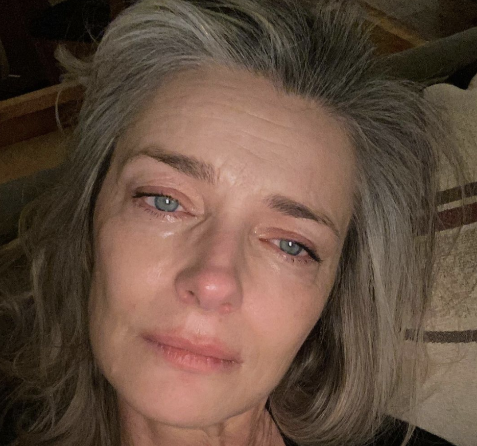 Paulina Porizkova shares a photo of a bad day she hurts my old skin