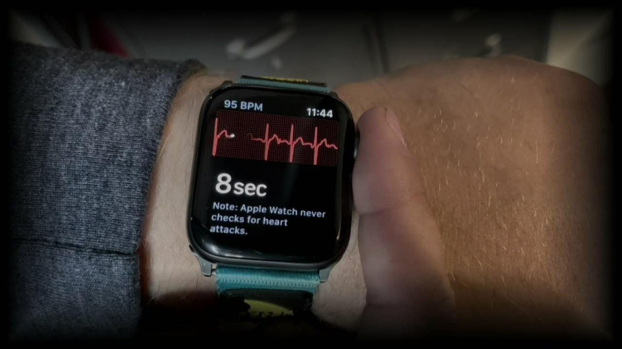 Apple Watch saves Woman's life by informing her of an asymptomatic heart attack