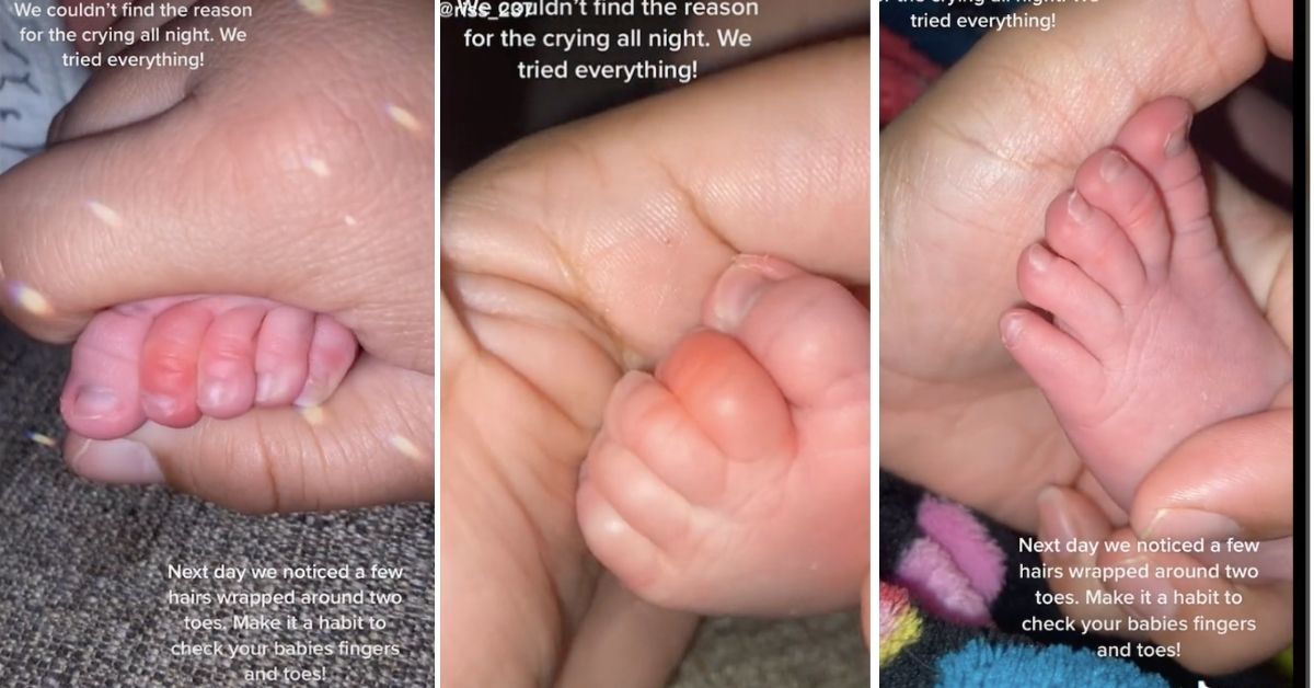 TikTok mum details frightening find on baby's toe: 'Another fear unlocked