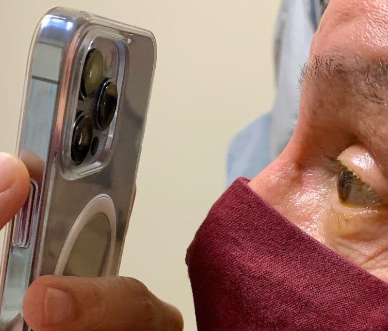 眼科医 Iphone 13 Proのマクロ撮影機能が 患者の診察に役立つ と報告 Engadget 日本版