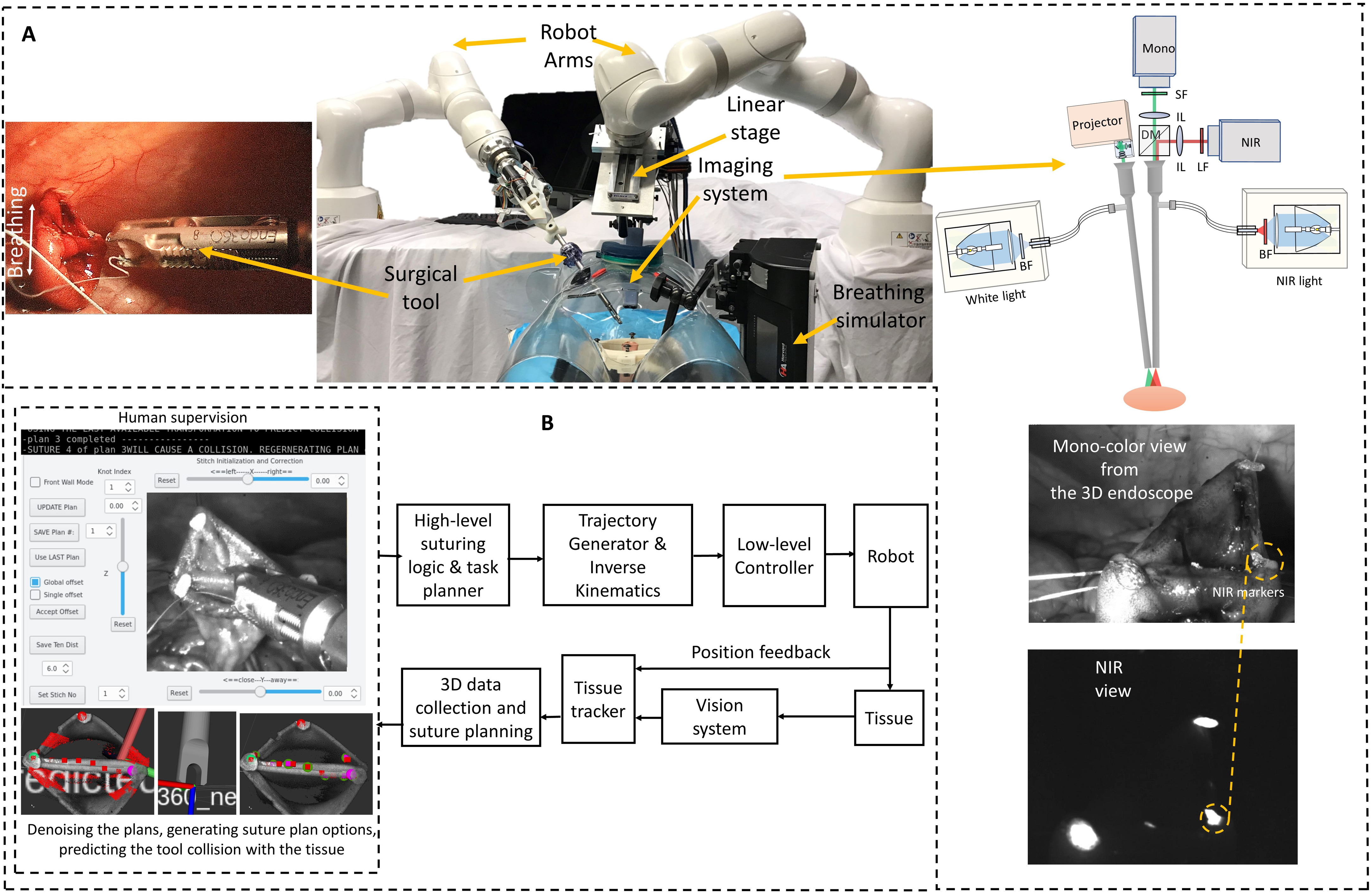 Robot performs complex 'keyhole' intestinal surgery on pigs without human aid