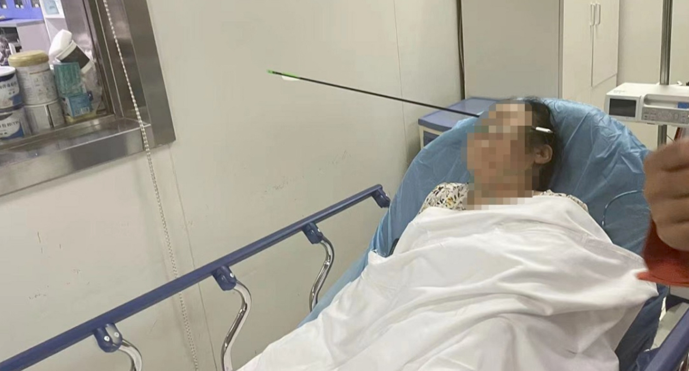 Woman hit in the head by stray arrow from practising archer