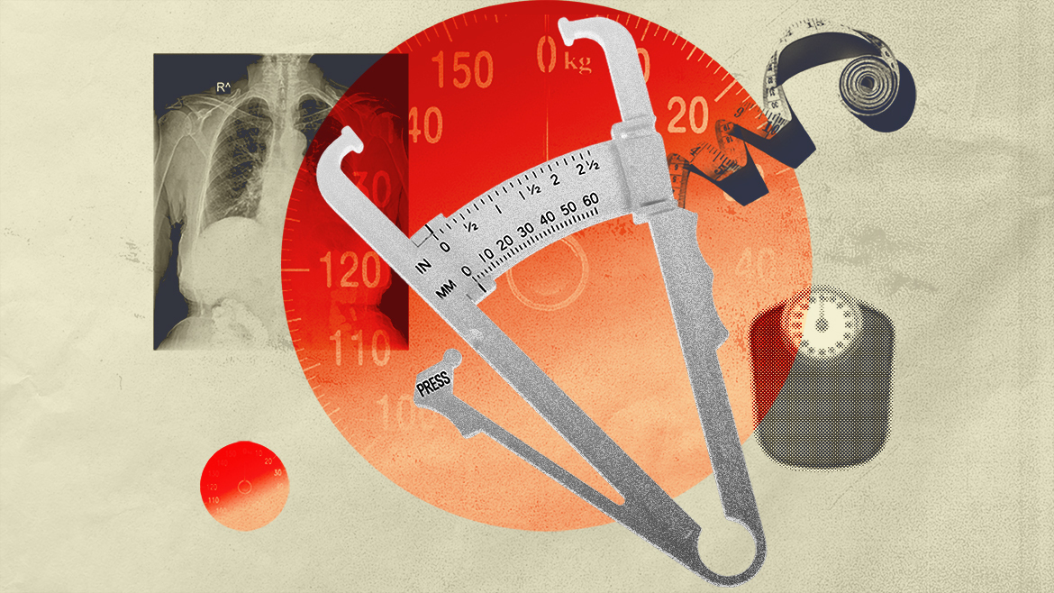 Why You Shouldn't Rely on BMI Alone > News > Yale Medicine