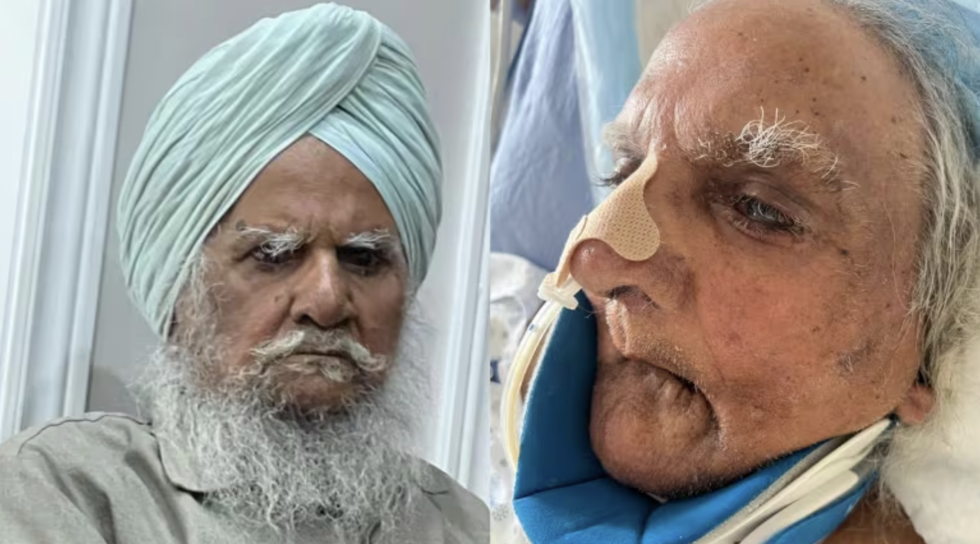 Outcry Over Sikh Patient Shaving Incident