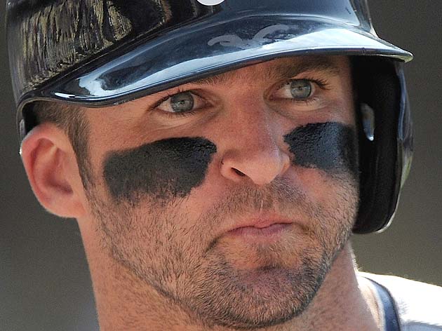 Dan Uggla's vision problems include astigmatism, and he might get Lasik  surgery