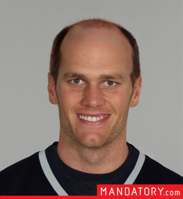 What would NFL quarterbacks look like if they were bald? One site shows us