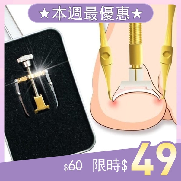 3爪嵌甲矯正器指甲矯正器凍甲崁甲卷甲腳趾甲矯正器甲溝炎nailsmall Nails Mall指甲美妝材料商城 Yahoo奇摩超級商城