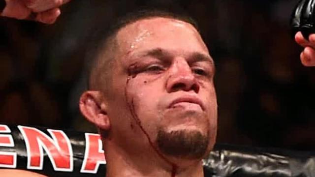 Dana White targeting Nate Diaz vs. Georges St-Pierre for UFC 227 matchup