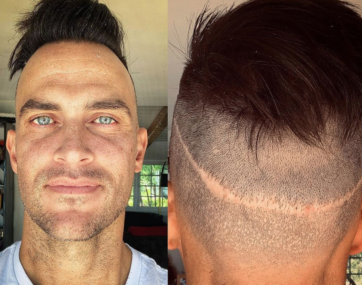 Actor Cheyenne Jackson reveals he's had 5 hair transplants: 'My horrible secret' - Yahoo Entertainment