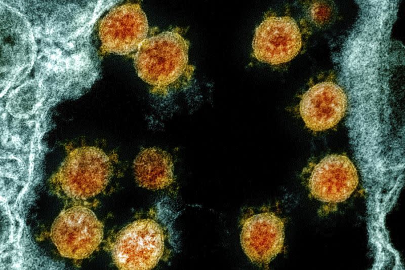Kanker dan  virus corona  adalah kombinasi berbahaya studi 