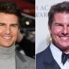 ¿Qué le ocurrió a Tom Cruise en la cara? Todos hablan de ello