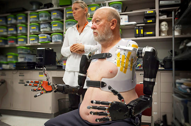 Double amputee controls two robotic arms with his mind