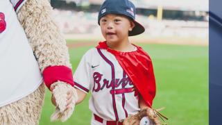 WATCH: Kirk Gibson surprises Dave LewAllen ahead of ceremonial first pitch