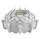 Edwards’ EVOQUE Valve Replacement System First Transcatheter Therapy to Earn FDA Approval for Tricuspid Valve