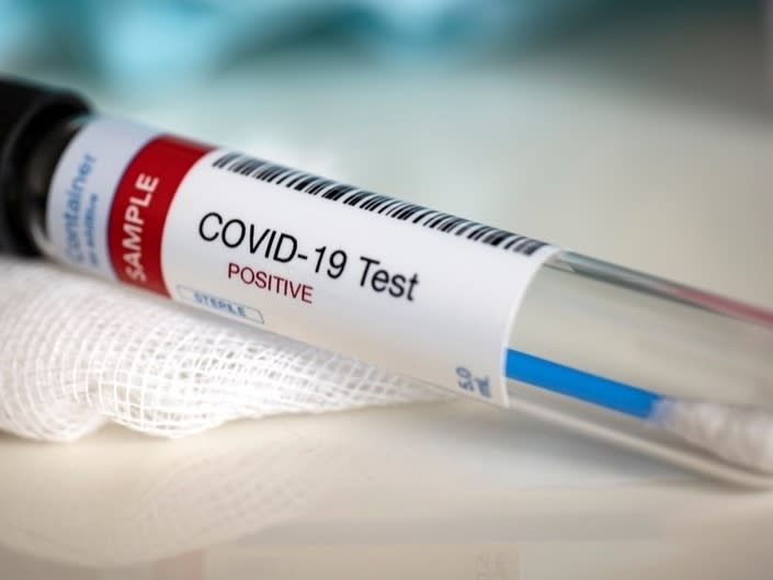 does cvs have rapid covid testing