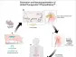 CORRECTING and REPLACING PHOTO United Therapeutics Announces World’s First Successful Xenothymokidney Transplant