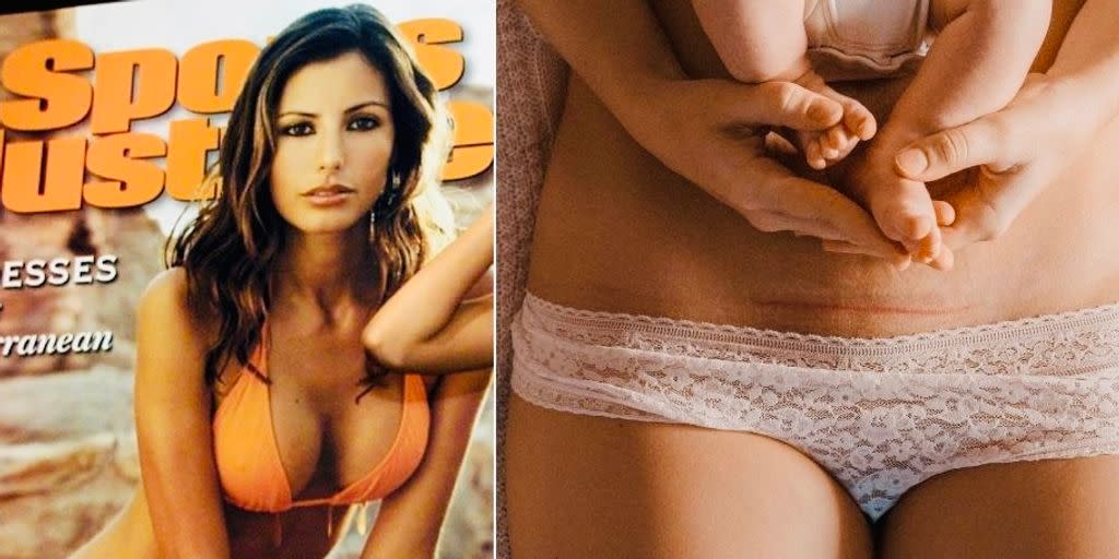 SI Swimsuit Features First Model With Visible C-Section Scar, And The Reactions ..