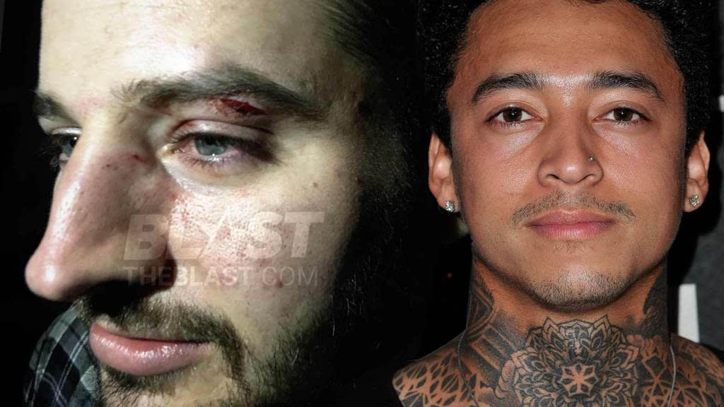 Nyjah Huston S Alleged Battery Victim S Injuries Seen For First Time As Olympic Skateboarder Prepares For Criminal Trial