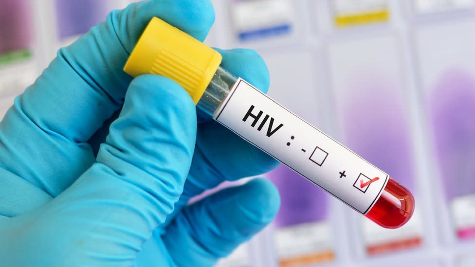 HIV findings in DR Congo give hope for cure