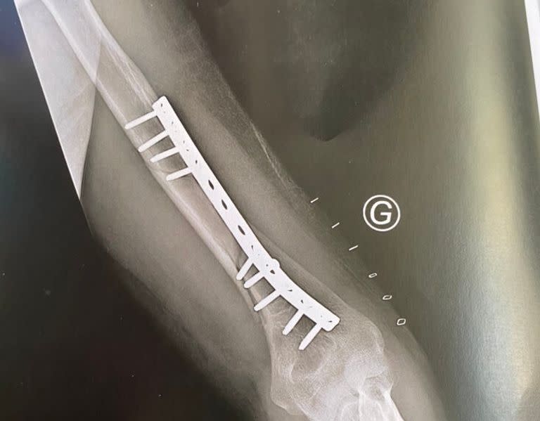 Comment un bras de fer a viré au cauchemar pour ce jeune Lillois