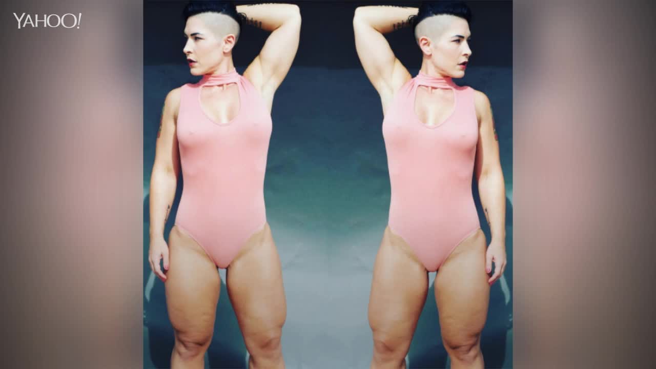 Woman With the 'World's Deadliest Thighs' Has Cellulite Too