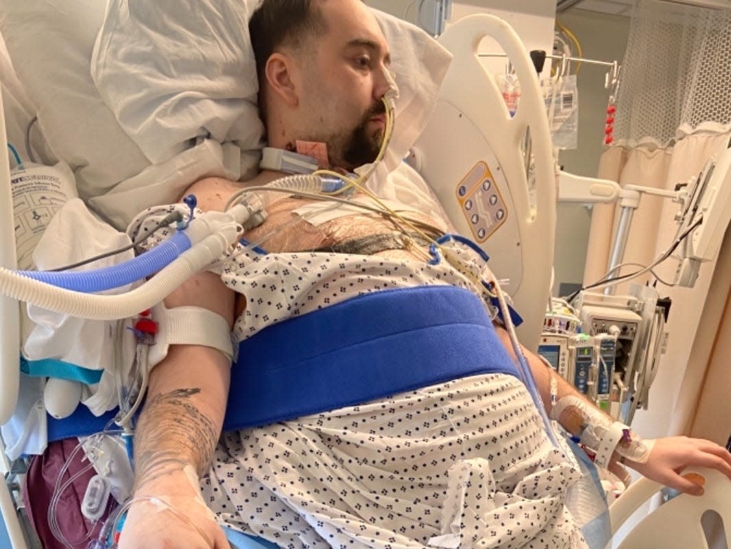 A 25-year-old who had to get a double lung transplant due to COVID-19 said his lungs look like 'chewed up pieces of bubblegum'