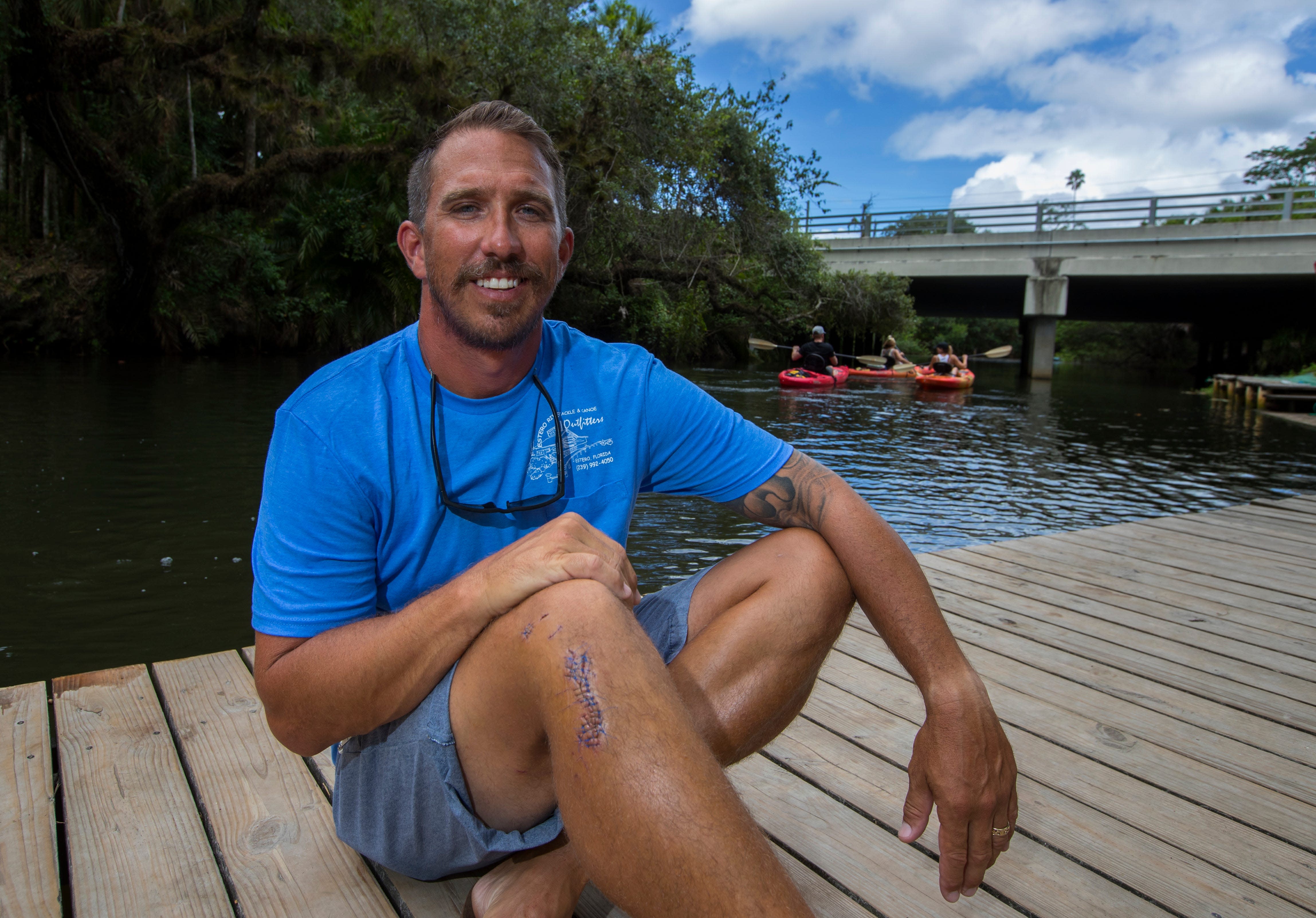 Florida man once bitten by alligator is chomped by 8-foot shark while on vacation