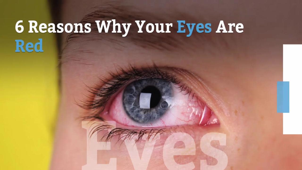 How To Tell The Difference Between Allergies And Pink Eye