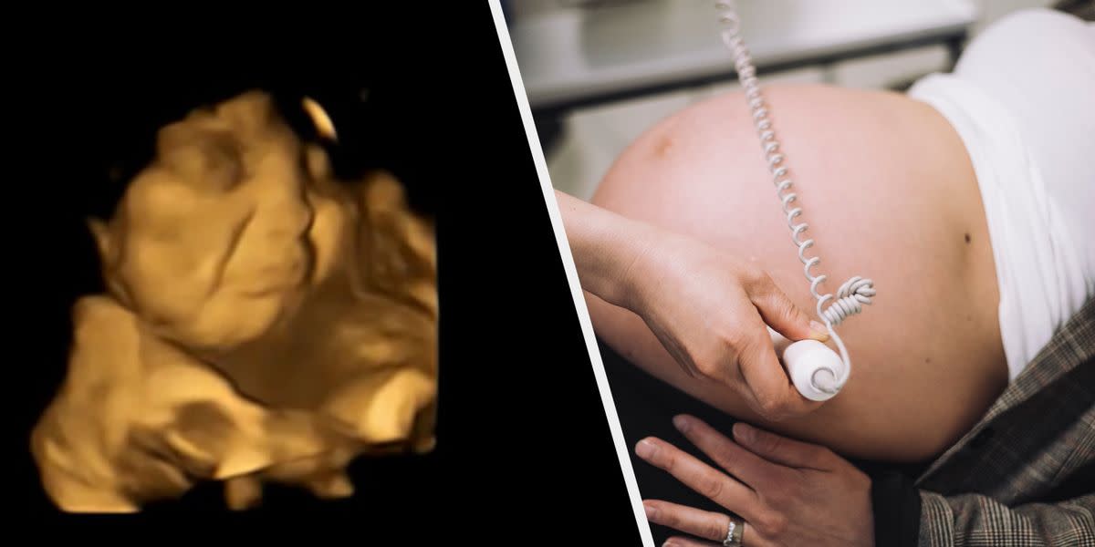 Ces scans fascinants montrent que les bébés réagissent dans l’utérus à ce que maman mange