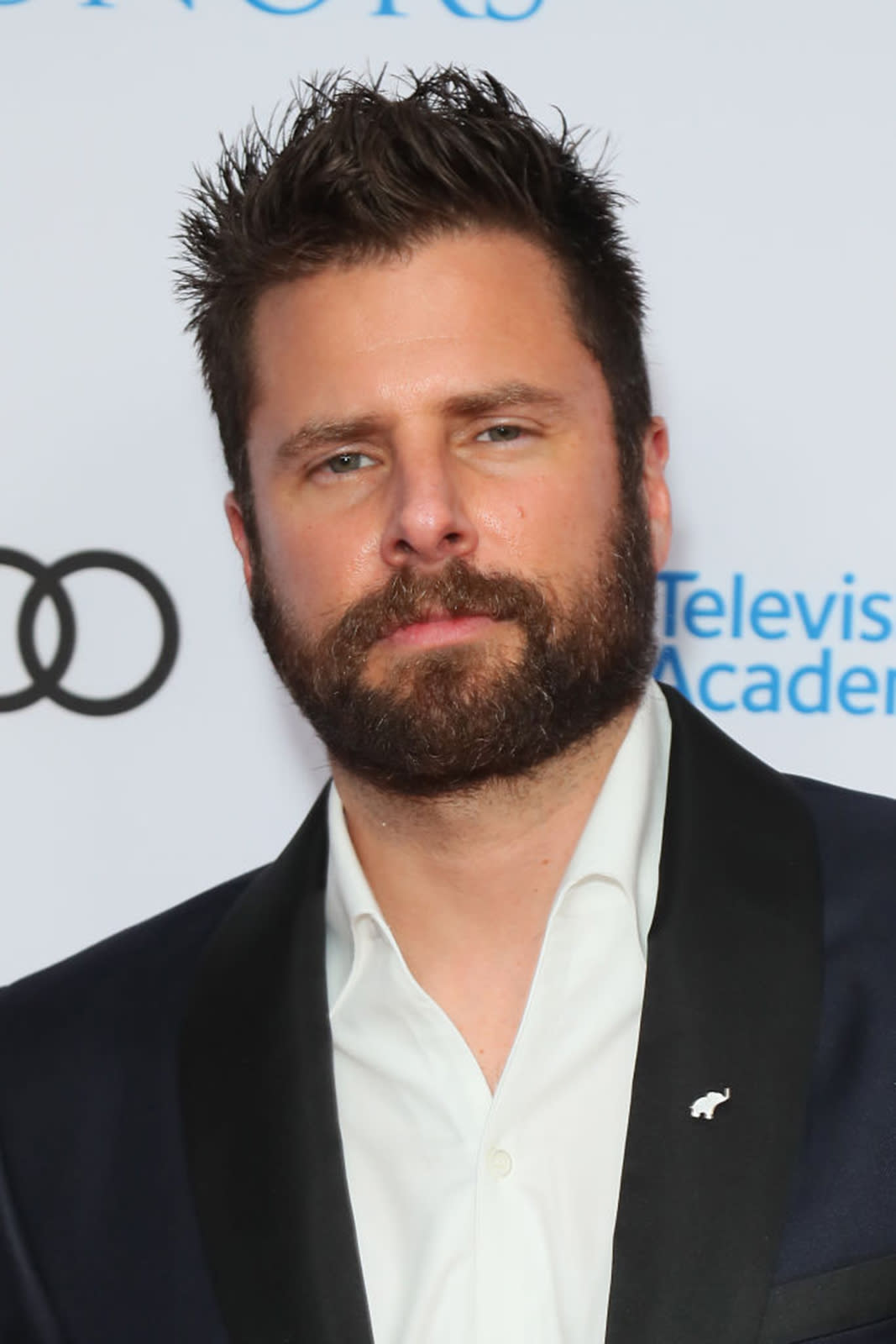 My worst moment: 'Psych' star James Roday Rodriguez and the stomach ...
