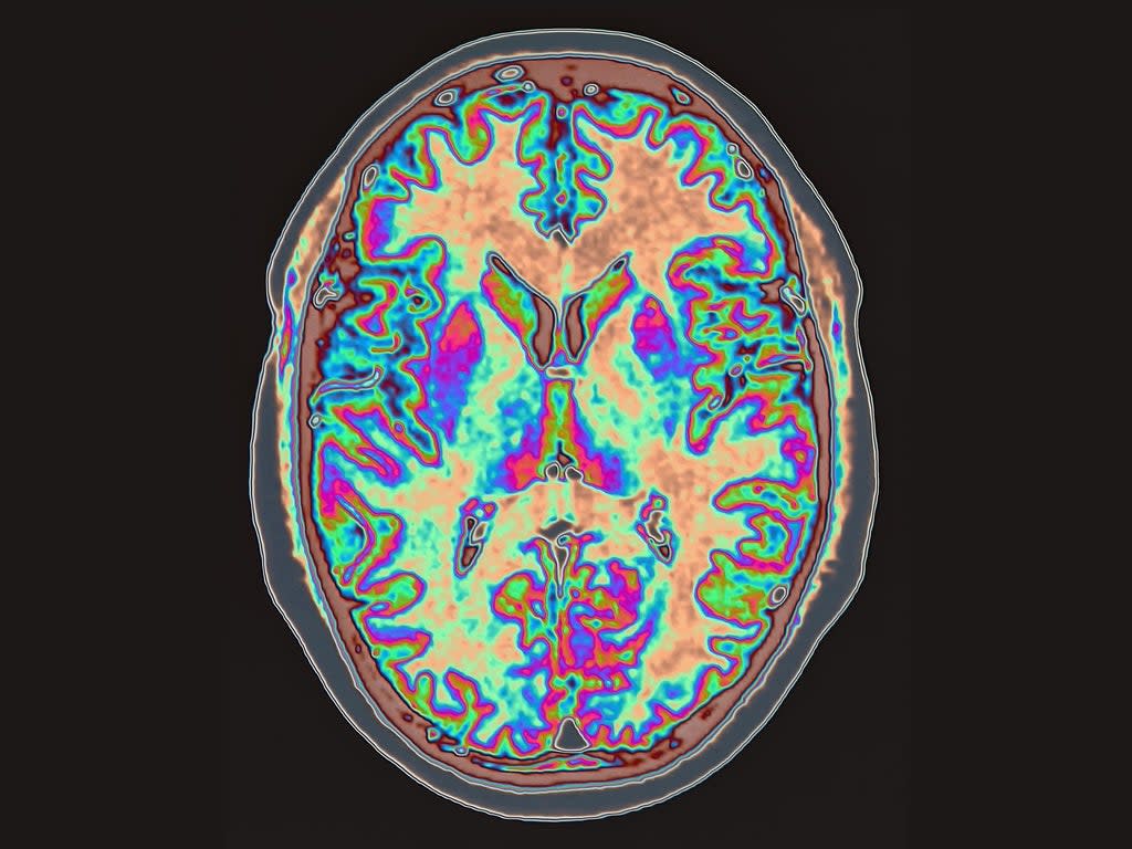 Scientists read brain waves to see what people picture in their mind’s eye