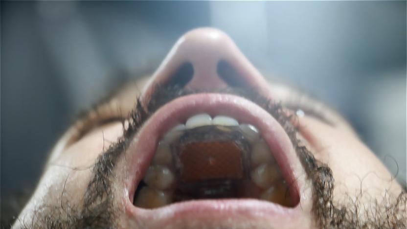 A down-up look at the MouthPad inside a person's mouth.
