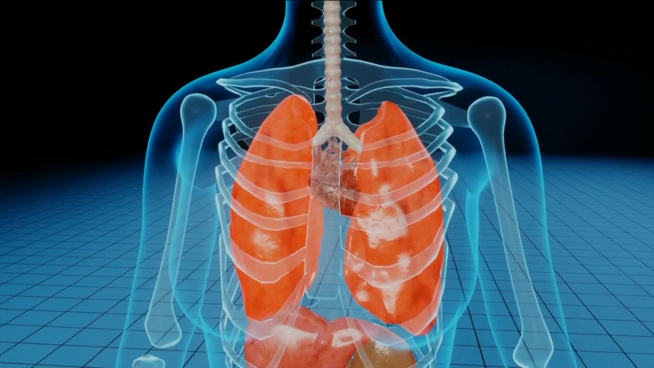 COVID-19 AND LUNG CANCER [Video]