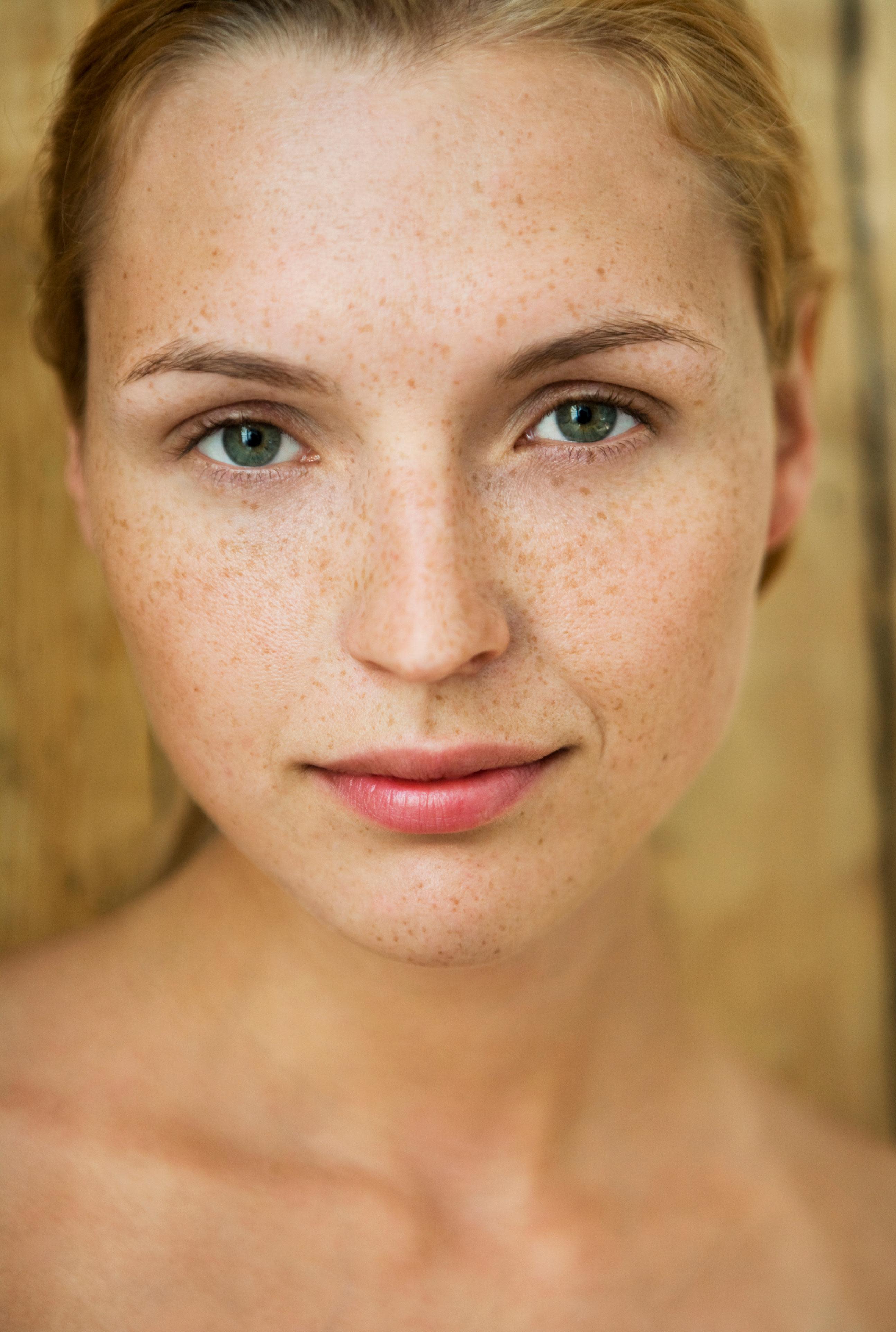 The Causes and Curses of Hyperpigmentation