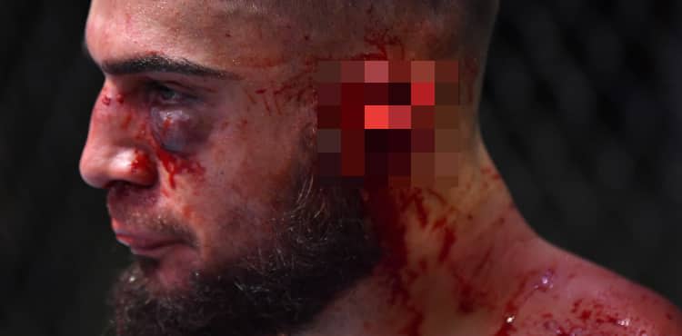 ufc-vegas-13-fighter-nearly-loses-ear-warning-graphic-image-peers-react-with-shock