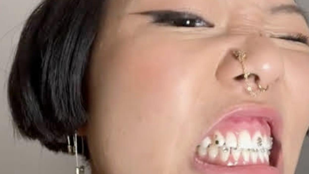 Up Your Mouth Bling With These Must-Have Tooth Gems - V Magazine