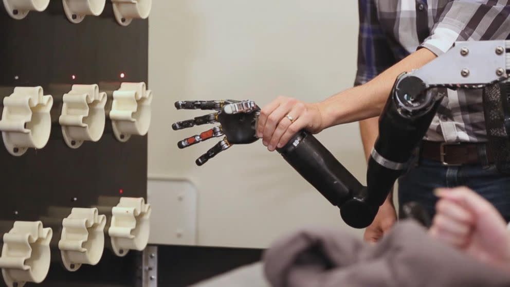 Bionic Hand and Brain Implant Allow Paralyzed Man to 'Feel' Again