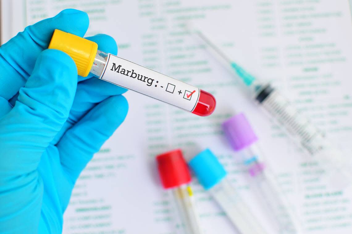Ghana declara un brote tras detectar dos muertes por la enfermedad de  Marburgo