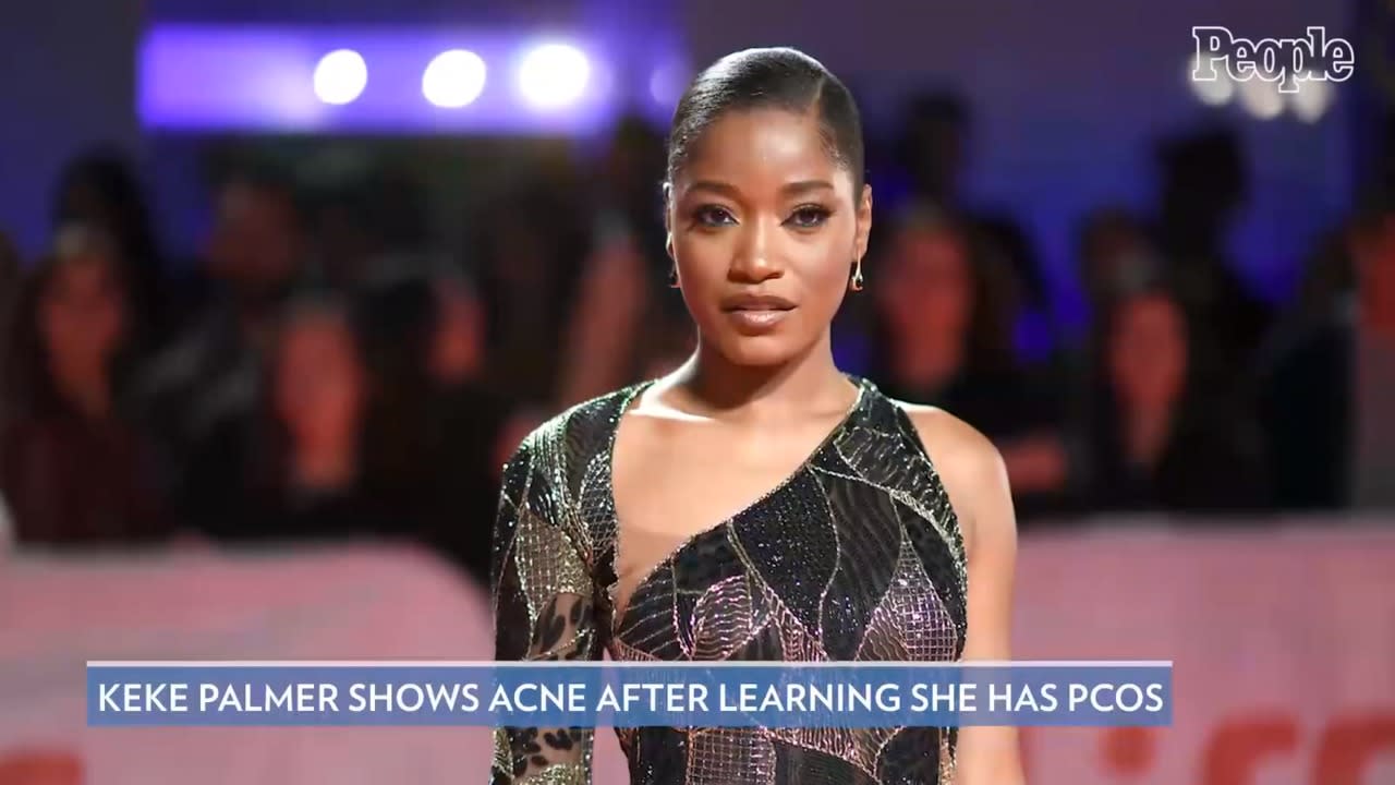 Keke Palmer Shares Acne-Coverage Tutorial on Instagram