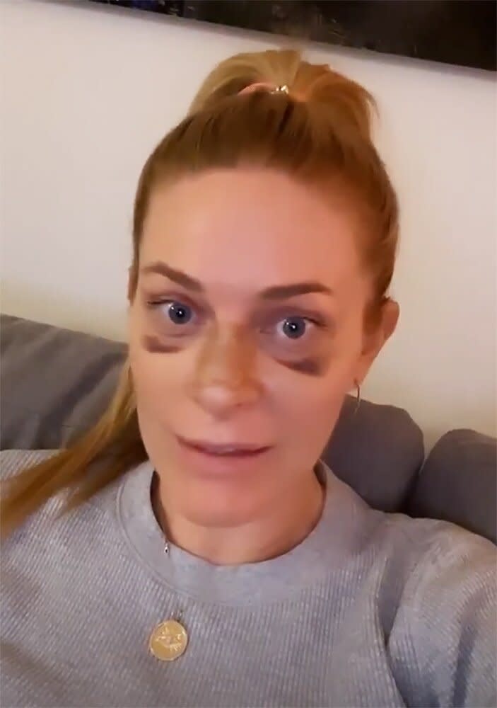 RHONY 's Leah McSweeney Reveals She Got a Nose Job: 'I Couldn't Be Happier'