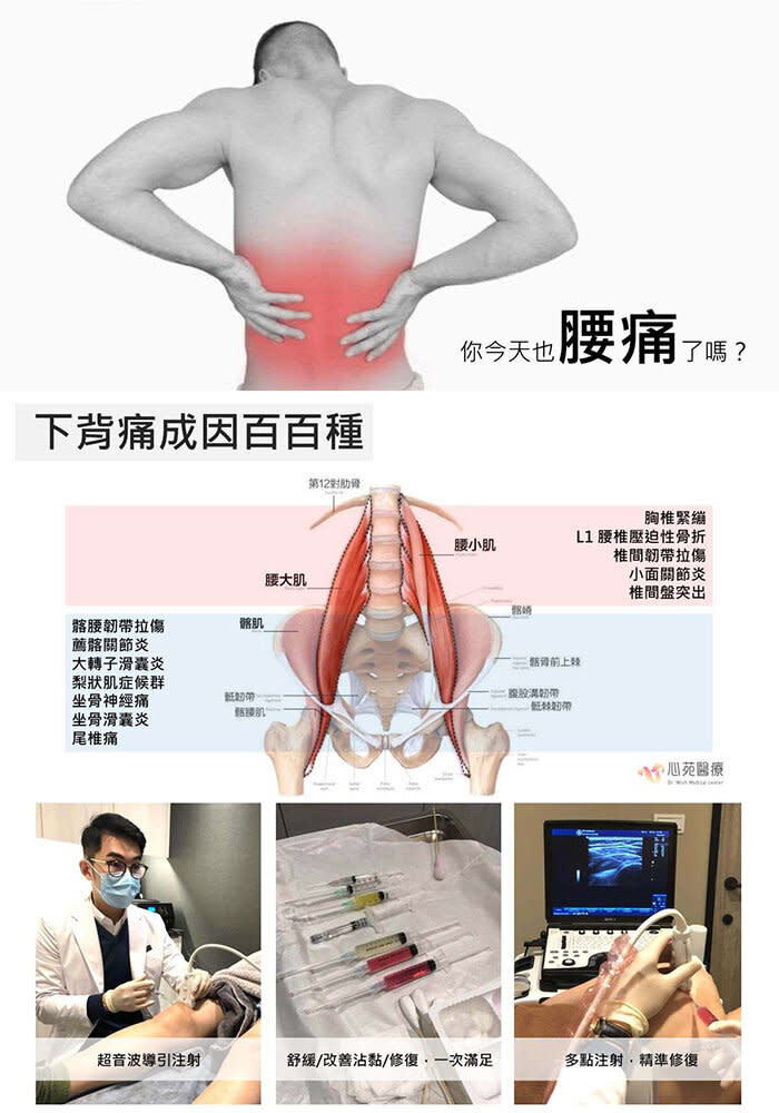 腰痛只能拉腰復健