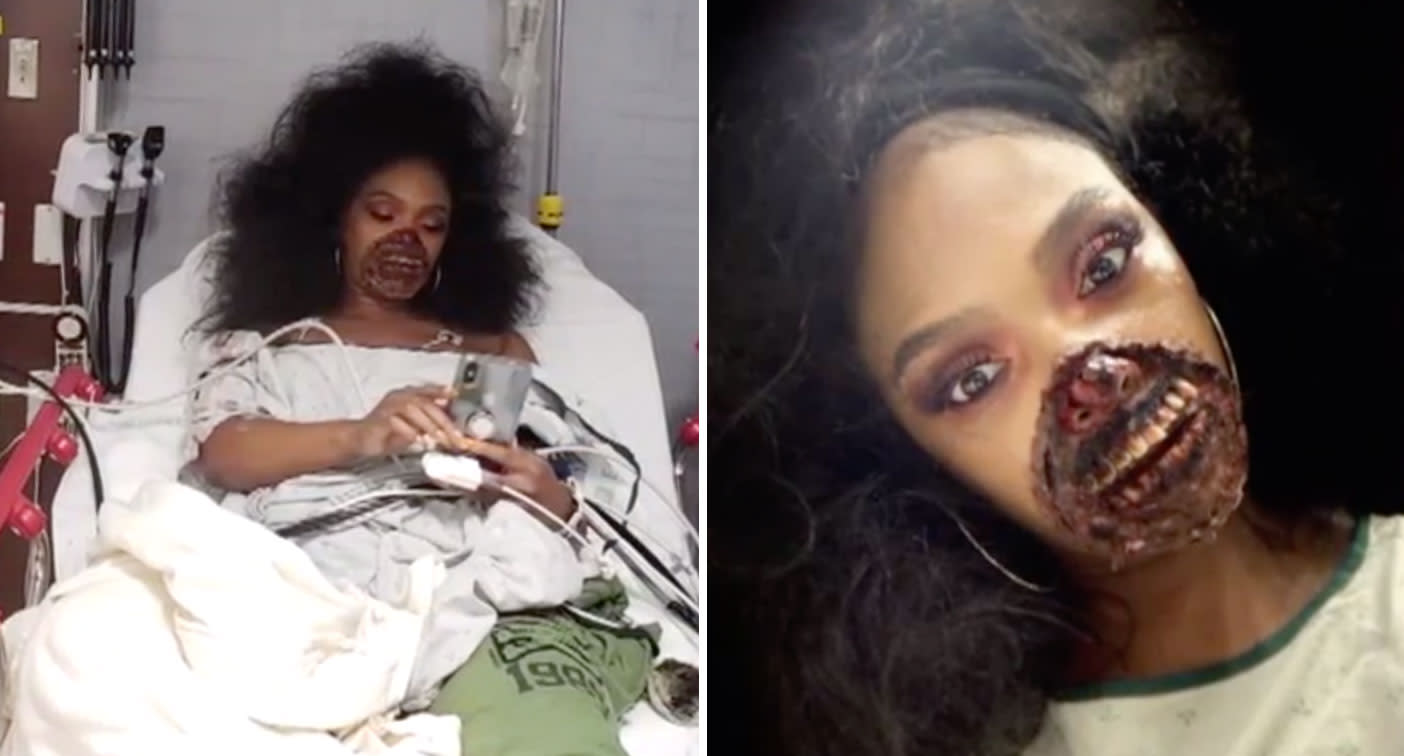 Woman treated for facial trauma at hospital with halloween make-up