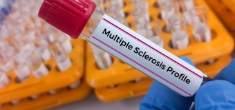 
Signs of MS can be detected in blood 5 years before symptoms appear